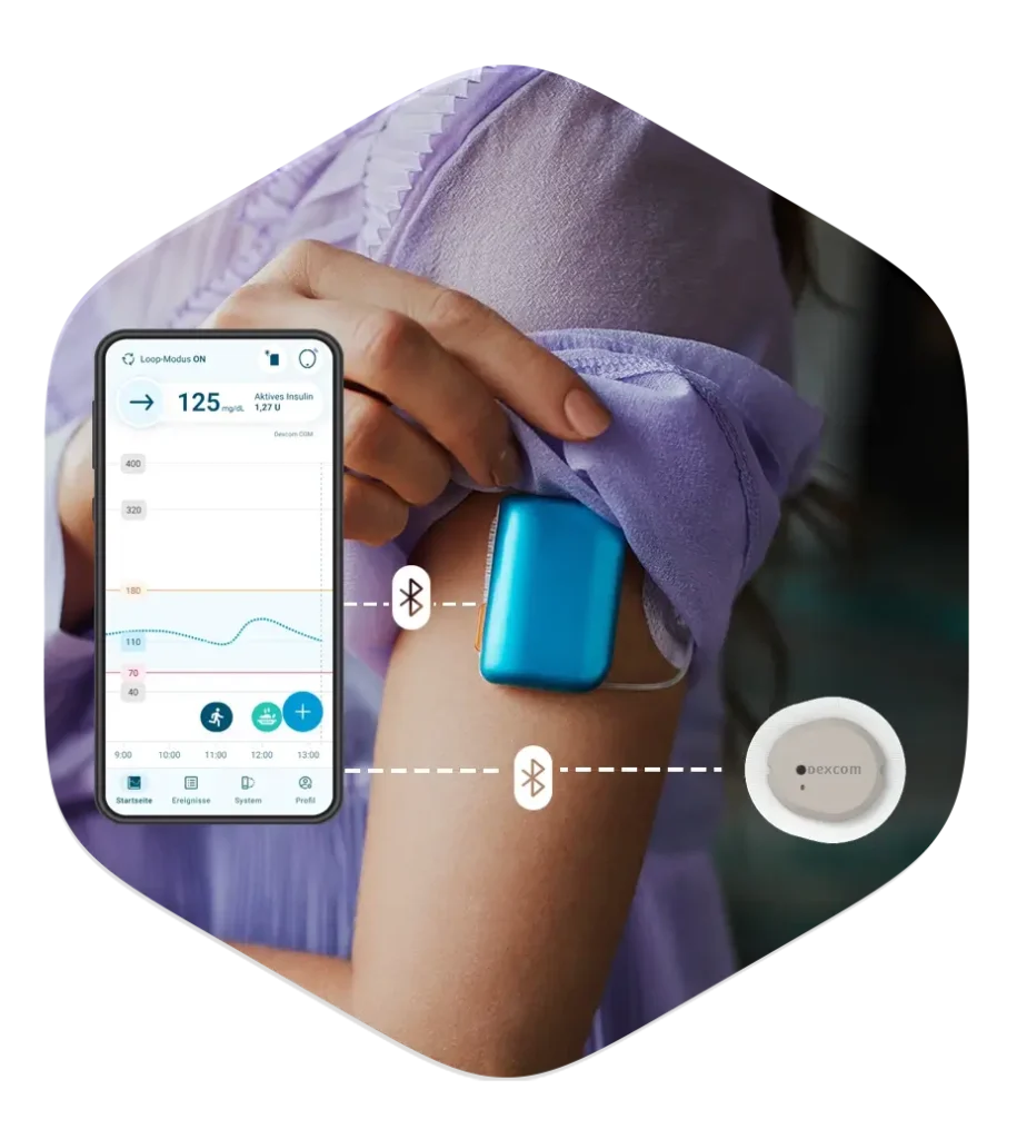 Kaleido, DBLG2 und Dexcom G7