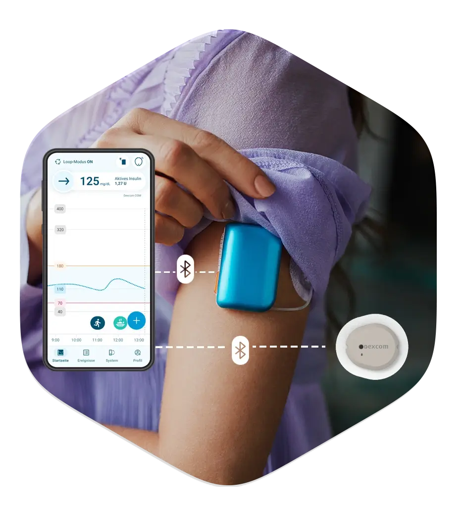 Kaleido, DBLG2 und Dexcom G7